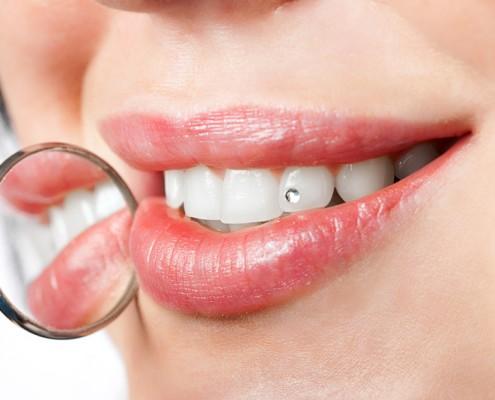 Dental jewelry under the magnifying glass