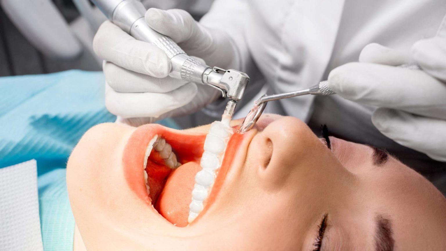 Professional teeth cleaning at the Zurich dentist